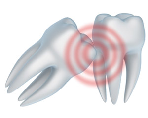 Stop the Toothache in West Palm Beach and Palm Beach Gardens